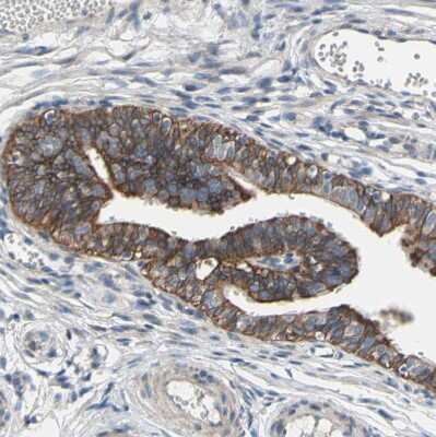 Immunohistochemistry-Paraffin: GRAMD3 Antibody [NBP1-82149]