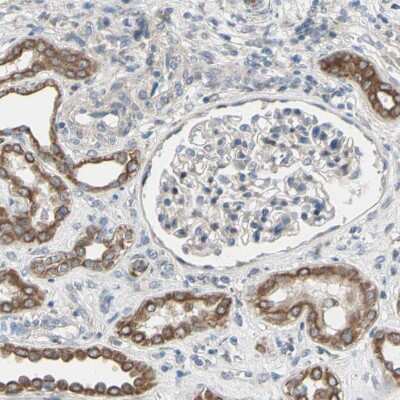 Immunohistochemistry-Paraffin: GRAMD3 Antibody [NBP1-82149]