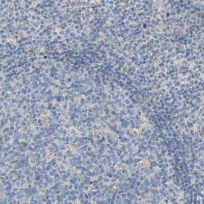 Immunohistochemistry-Paraffin: GRAMD3 Antibody [NBP1-82149]