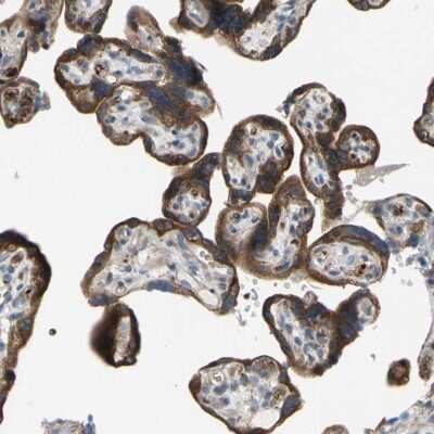 Immunohistochemistry-Paraffin: GRAMD3 Antibody [NBP1-82149]