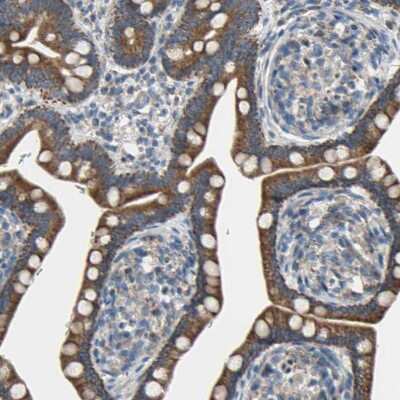 Immunohistochemistry-Paraffin: GRAMD3 Antibody [NBP1-82149]