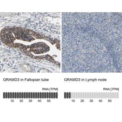Immunohistochemistry-Paraffin: GRAMD3 Antibody [NBP1-82149]
