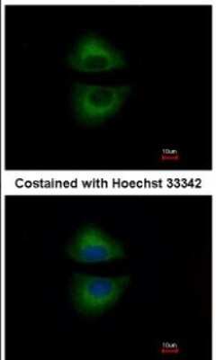 Immunocytochemistry/ Immunofluorescence: GRAP Antibody [NBP1-33626]