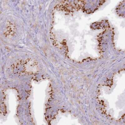 Immunohistochemistry-Paraffin: GRAP Antibody [NBP1-91969]