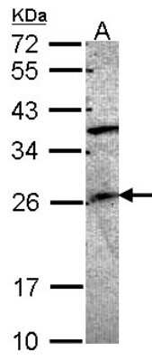 Western Blot: GRAP Antibody [NBP1-33626]