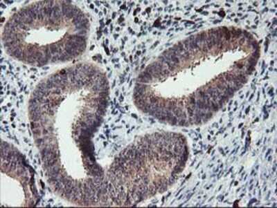 Immunohistochemistry-Paraffin: GRAP2 Antibody (OTI1G2) [NBP2-00764]