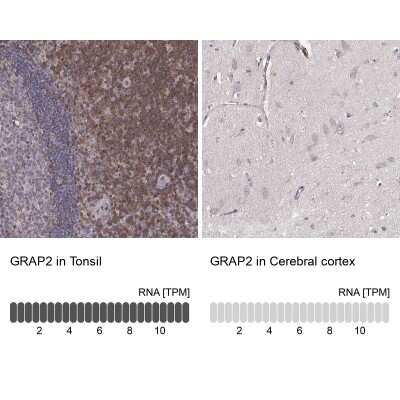 Immunohistochemistry-Paraffin: GRAP2 Antibody [NBP1-83399]