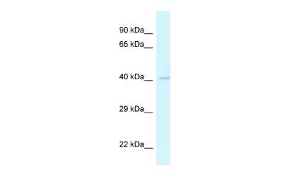 Western Blot: GRASP Antibody [NBP2-85015]