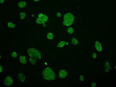 Immunocytochemistry/ Immunofluorescence: GRASP1 Antibody (OTI1E3) [NBP2-02277]
