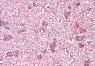 Immunohistochemistry-Paraffin: GRASP1 Antibody [NB100-1432]