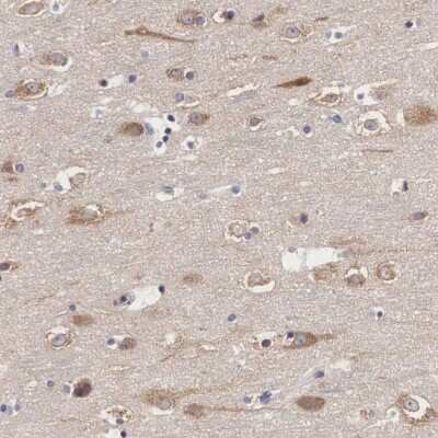 Immunohistochemistry-Paraffin: GRASP1 Antibody [NBP1-85103]