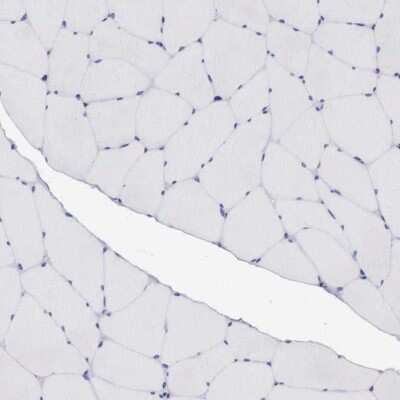 Immunohistochemistry-Paraffin: GRASP1 Antibody [NBP1-85103]