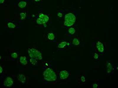 Immunocytochemistry/ Immunofluorescence: GRASP1 Antibody (OTI1E3) - Azide and BSA Free [NBP2-72064]