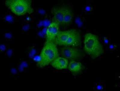 Immunocytochemistry/ Immunofluorescence: GRASP1 Antibody (OTI1E3) - Azide and BSA Free [NBP2-72064]