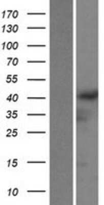Western Blot: GRASP Overexpression Lysate [NBP2-04899]