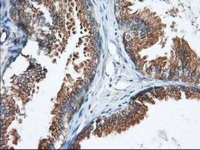 Immunohistochemistry: GRASP65 Antibody (OTI5G8) - Azide and BSA Free [NBP2-72144]
