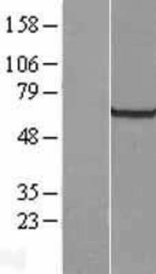 Western Blot: GRB 14 Overexpression Lysate [NBL1-11325]