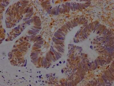 Immunohistochemistry: GRB2 Antibody (6E1) [NBP3-15167]