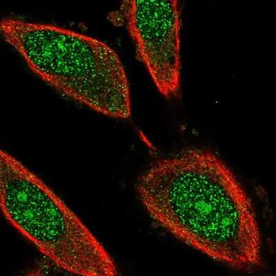 Immunocytochemistry/ Immunofluorescence: GRB2 Antibody [NBP2-55208]
