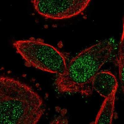 Immunocytochemistry/ Immunofluorescence: GRB2 Antibody [NBP2-55209]