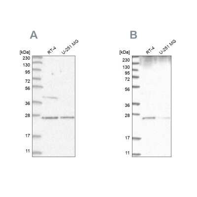 Western Blot: GRB2 Antibody [NBP2-55208]