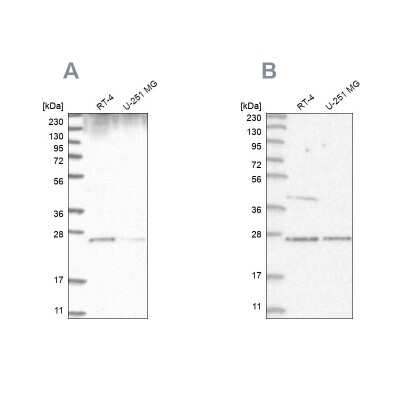 Western Blot: GRB2 Antibody [NBP2-55209]