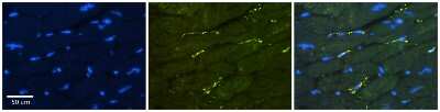 Immunohistochemistry-Paraffin: GREB1 Antibody [NBP3-10341]