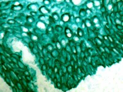 Immunohistochemistry-Paraffin: GREEN AP Plus Staining Kit (Colorimetric) [NBP3-12170]