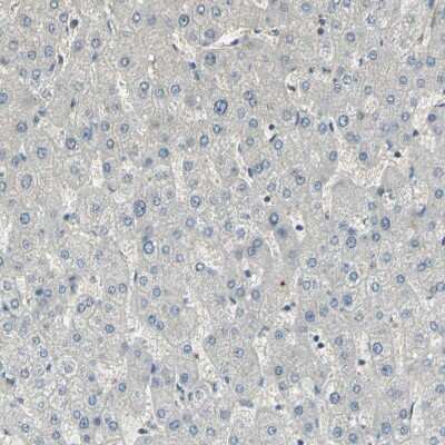 Immunohistochemistry-Paraffin: GRF2 Antibody [NBP1-88266]