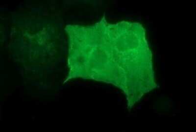 Immunocytochemistry/ Immunofluorescence: GRF2 Antibody (OTI2F5) - Azide and BSA Free [NBP2-70846]