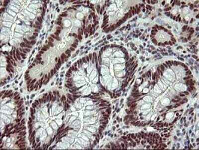 Immunohistochemistry: GRF2 Antibody (OTI2F5) - Azide and BSA Free [NBP2-70846]