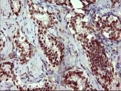 Immunohistochemistry: GRF2 Antibody (OTI2F5) - Azide and BSA Free [NBP2-70846]