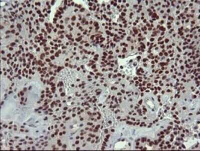 Immunohistochemistry: GRF2 Antibody (OTI2F5) - Azide and BSA Free [NBP2-70846]
