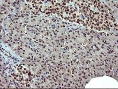 Immunohistochemistry: GRF2 Antibody (OTI2F5) - Azide and BSA Free [NBP2-70846]