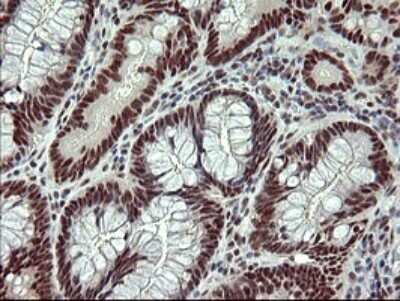 Immunohistochemistry: GRF2 Antibody (OTI2F5) [NBP2-45515]