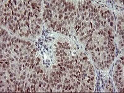 Immunohistochemistry: GRF2 Antibody (OTI2F5) [NBP2-45515]