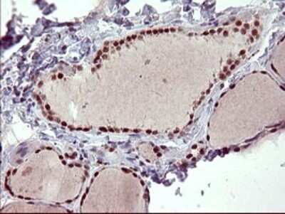 Immunohistochemistry: GRF2 Antibody (OTI2F5) [NBP2-45515]