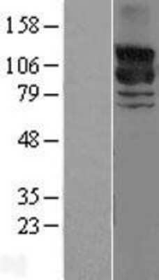 Western Blot: GRF2 Overexpression Lysate [NBL1-15151]