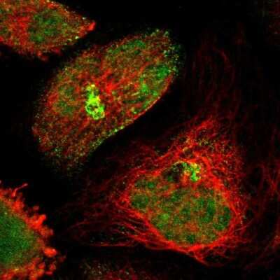 Immunocytochemistry/ Immunofluorescence: GRHL1 Antibody [NBP1-81321]