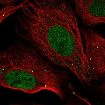 Immunocytochemistry/ Immunofluorescence: GRHL1 Antibody [NBP1-81322]