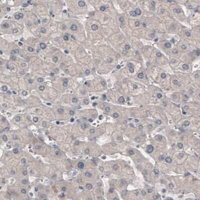 Immunohistochemistry-Paraffin: GRHL2 Antibody (CL3760) [NBP2-61634]