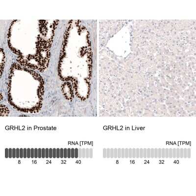 Immunohistochemistry-Paraffin: GRHL2 Antibody (CL3760) [NBP2-61634]