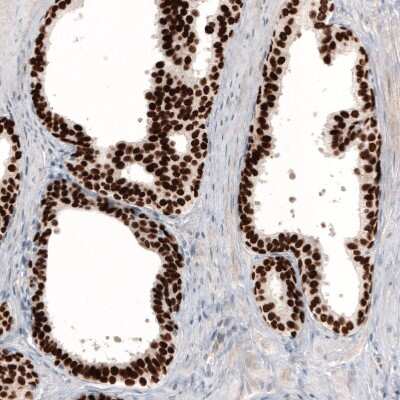 Immunohistochemistry-Paraffin: GRHL2 Antibody (CL3760) [NBP2-61634]