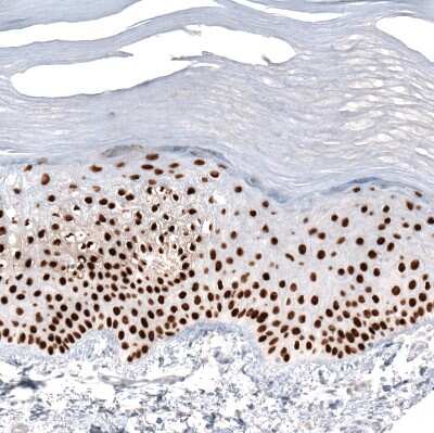 Immunohistochemistry-Paraffin: GRHL2 Antibody (CL3760) [NBP2-61634]