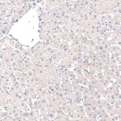 Immunohistochemistry-Paraffin: GRHL2 Antibody (CL3760) [NBP2-61634]