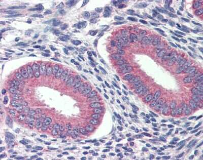Immunohistochemistry: GRHL2 Antibody [NBP1-80369]