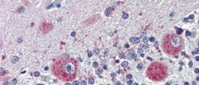 Immunohistochemistry-Paraffin: GRHL2 Antibody [NBP1-80369]