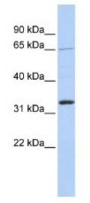 Western Blot: GRHL2 Antibody [NBP1-80369]