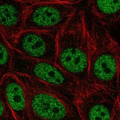 Immunocytochemistry/ Immunofluorescence: GRHL3 Antibody [NBP2-57087]