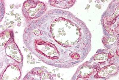 Immunohistochemistry-Paraffin: GRHL3 Antibody [NBP1-80355]